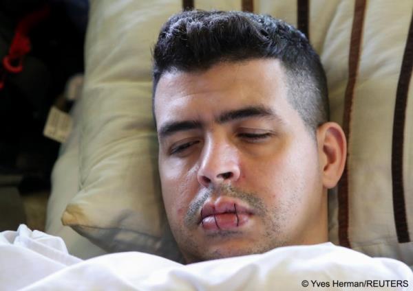 sofiane, an asylum seeker, is seen with his lips sewed together